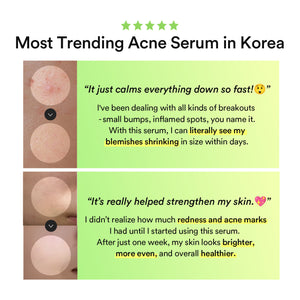 Heartleaf Teca capsule serum Calming drop