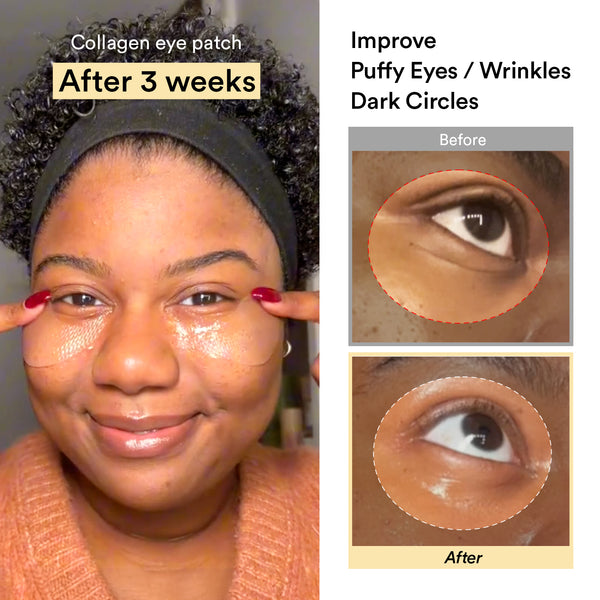 Eye-Deal Collagen Eye Care Kit