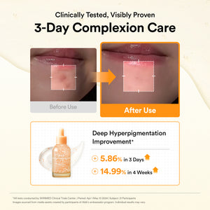 Glutathiosome dark spot serum Vita drop