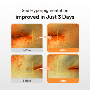 Uneven Skin Tone Trio